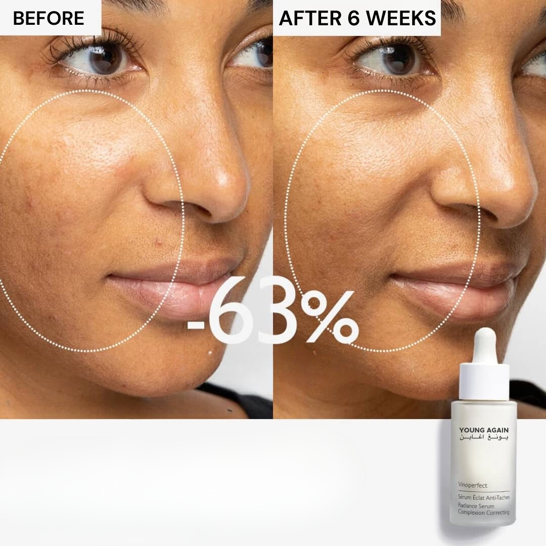 Young Again Anti-aging Cream