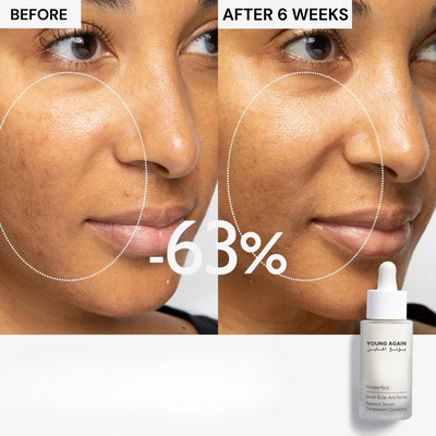 Young Again Anti-aging Cream
